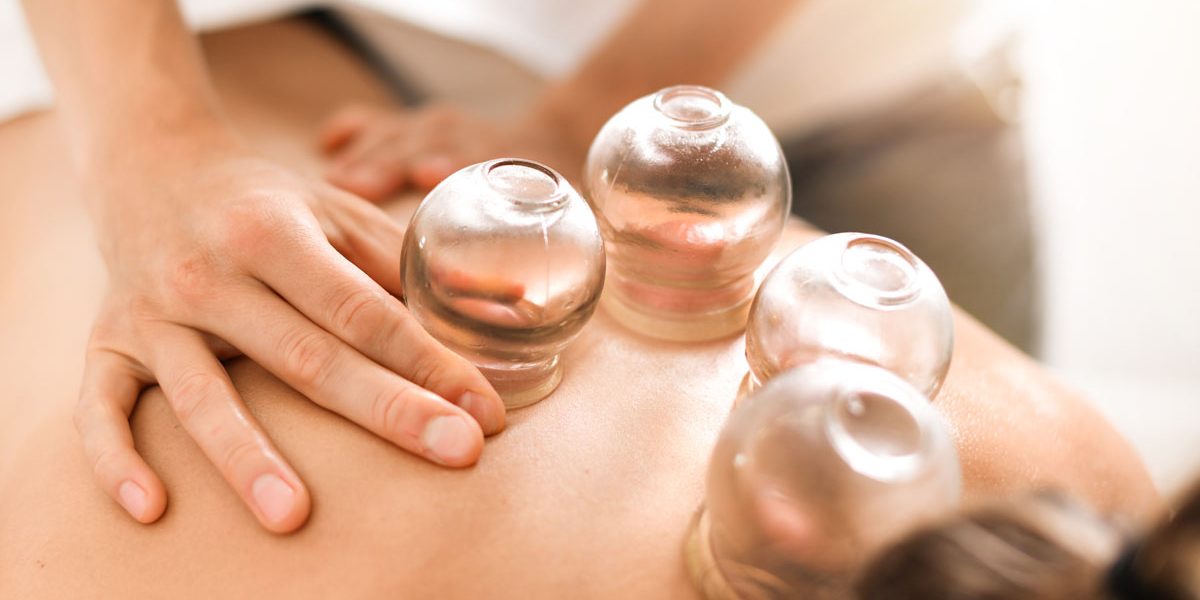 Detail of a woman therapist hands giving cupping treatment on back.